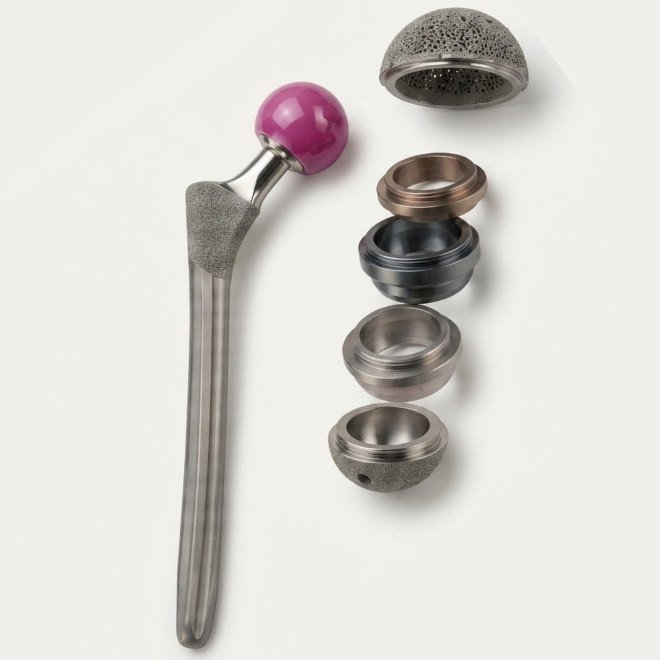 Revision Hip Replacement